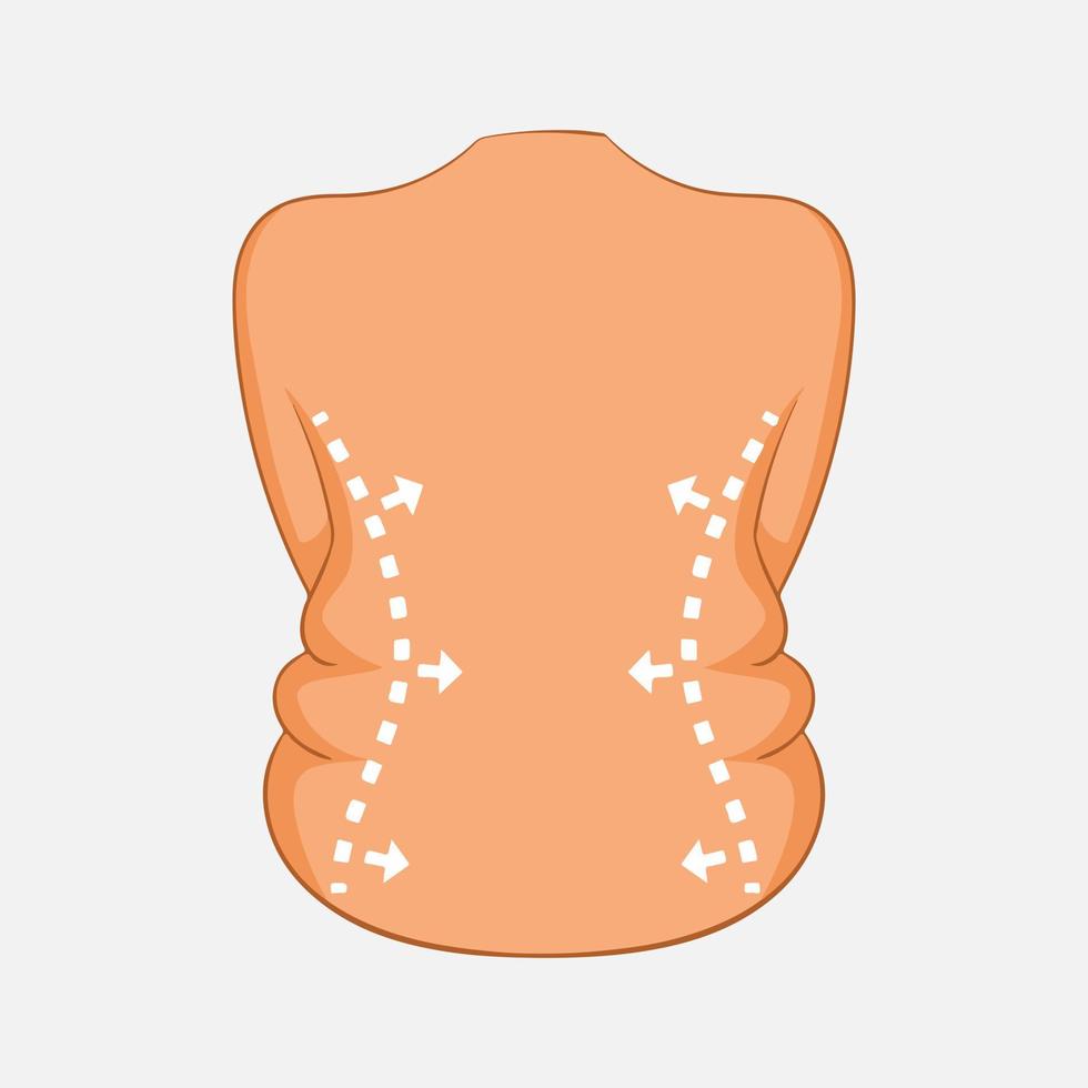 Cellulite removal, Before and after cellulite removal vector