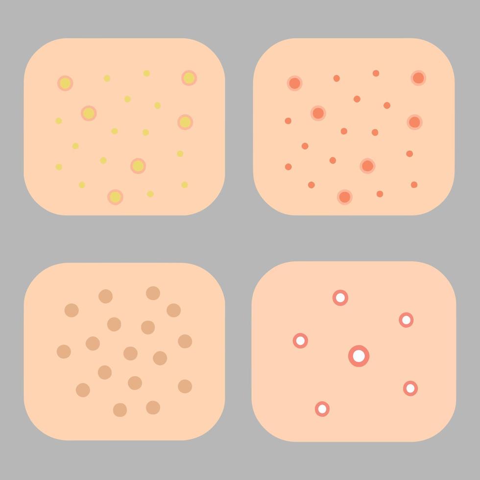 Acne allergies vector inflammation damage scar disease design
