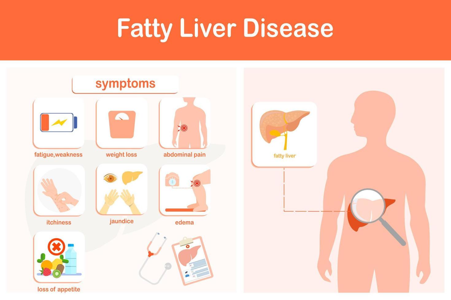 Vector illustration. Infographic of fatty liver disease.  Weakness, jaundice, edema, pain in the right side of the abdomen, decreased appetite, and rapid weight loss.