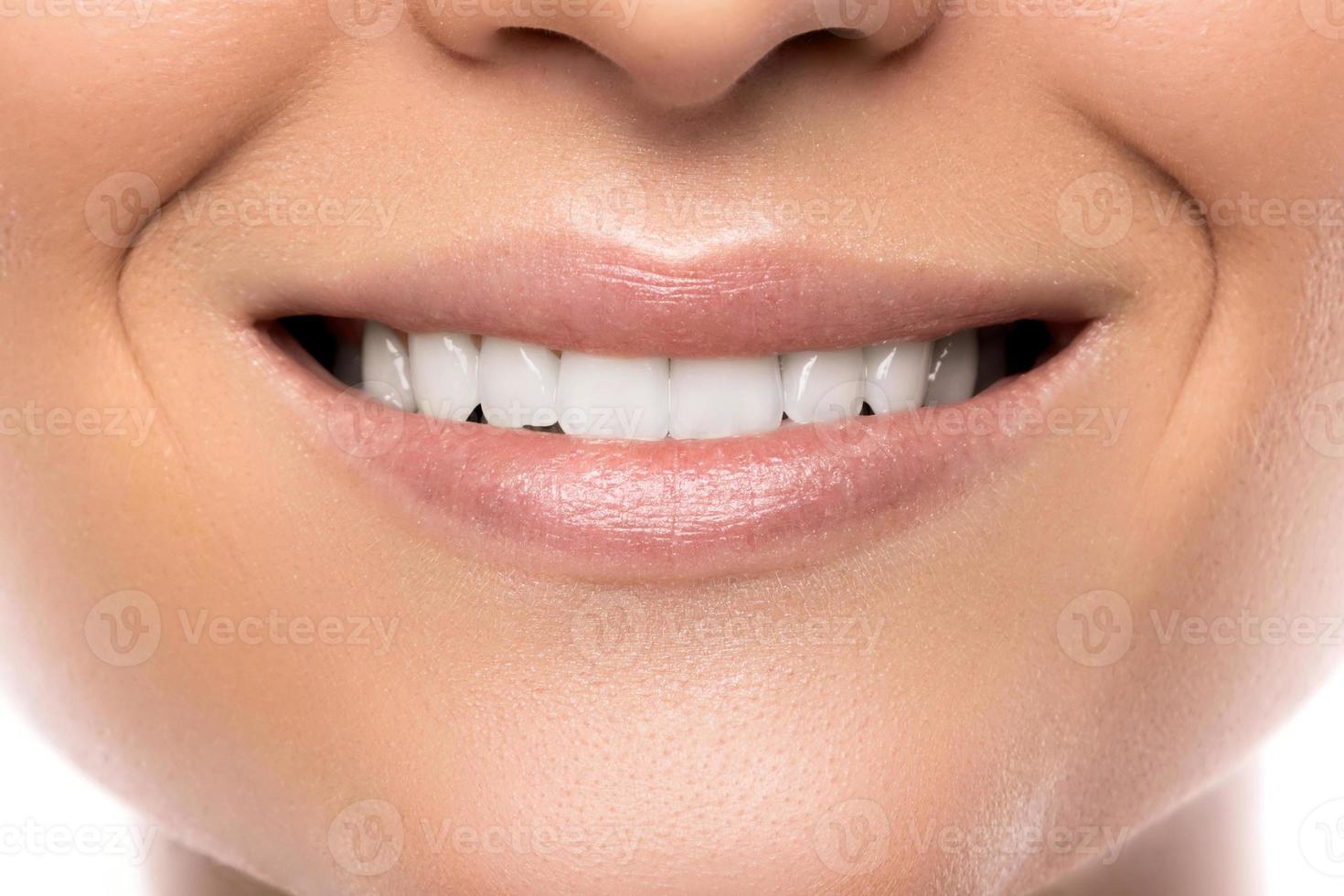 Closeup of beautiful female smile with white teeth photo
