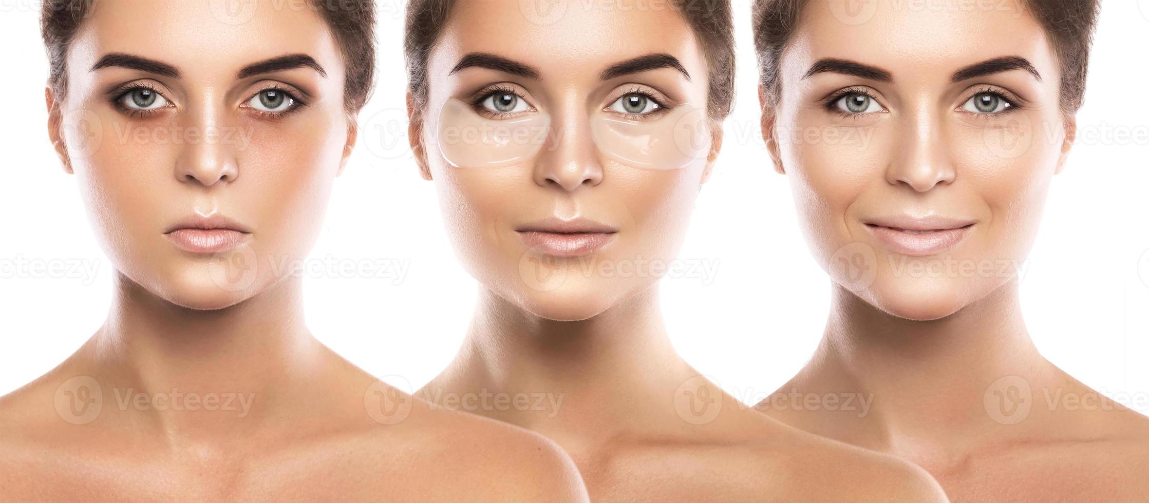 Woman with collagen pads under her eyes photo