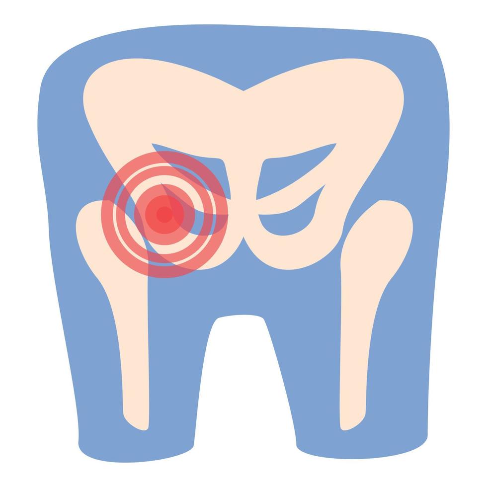 vector de dibujos animados de icono de dolor articular. artritis medica