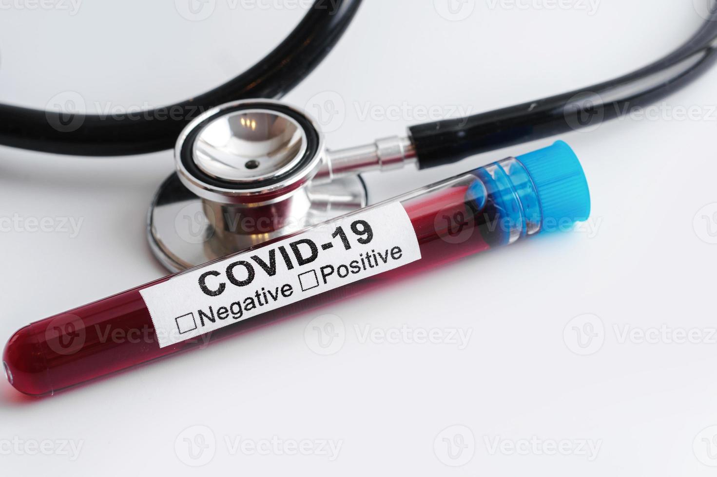 Blood samples and stethoscope on white background photo