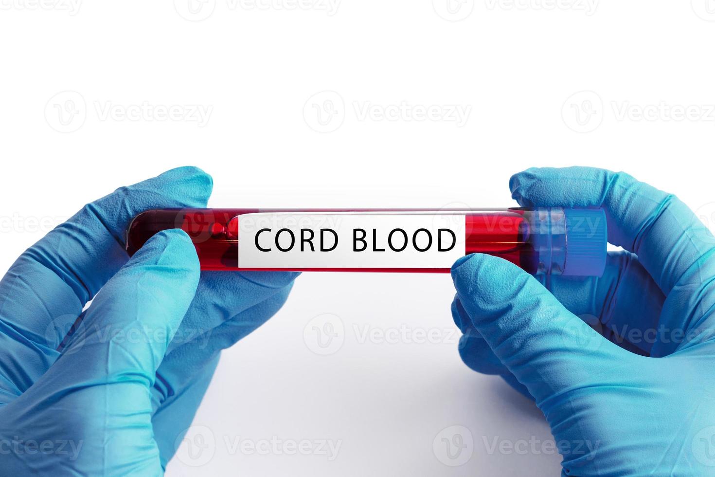 Close up of scientist hand with a cord blood ampoule photo