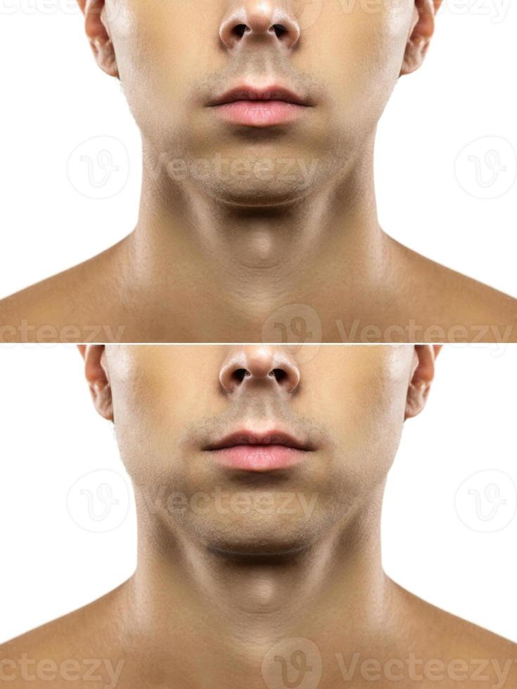 mewing before after result  Jawline exercise, Face, Facial