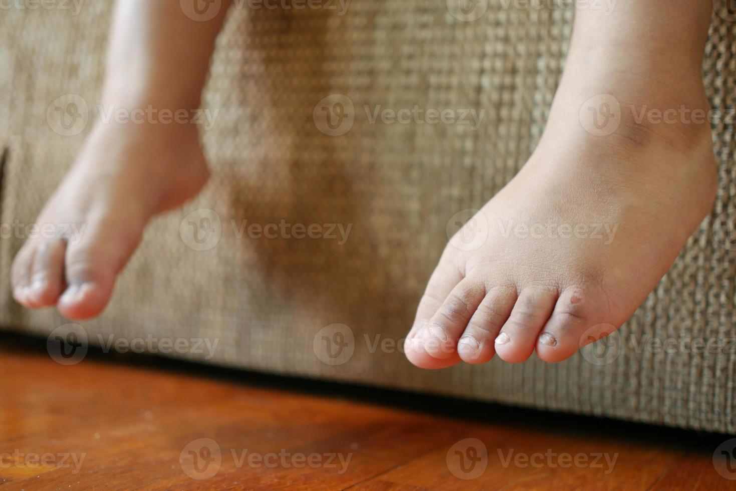 close up of 5 years old child dry feet on bed photo