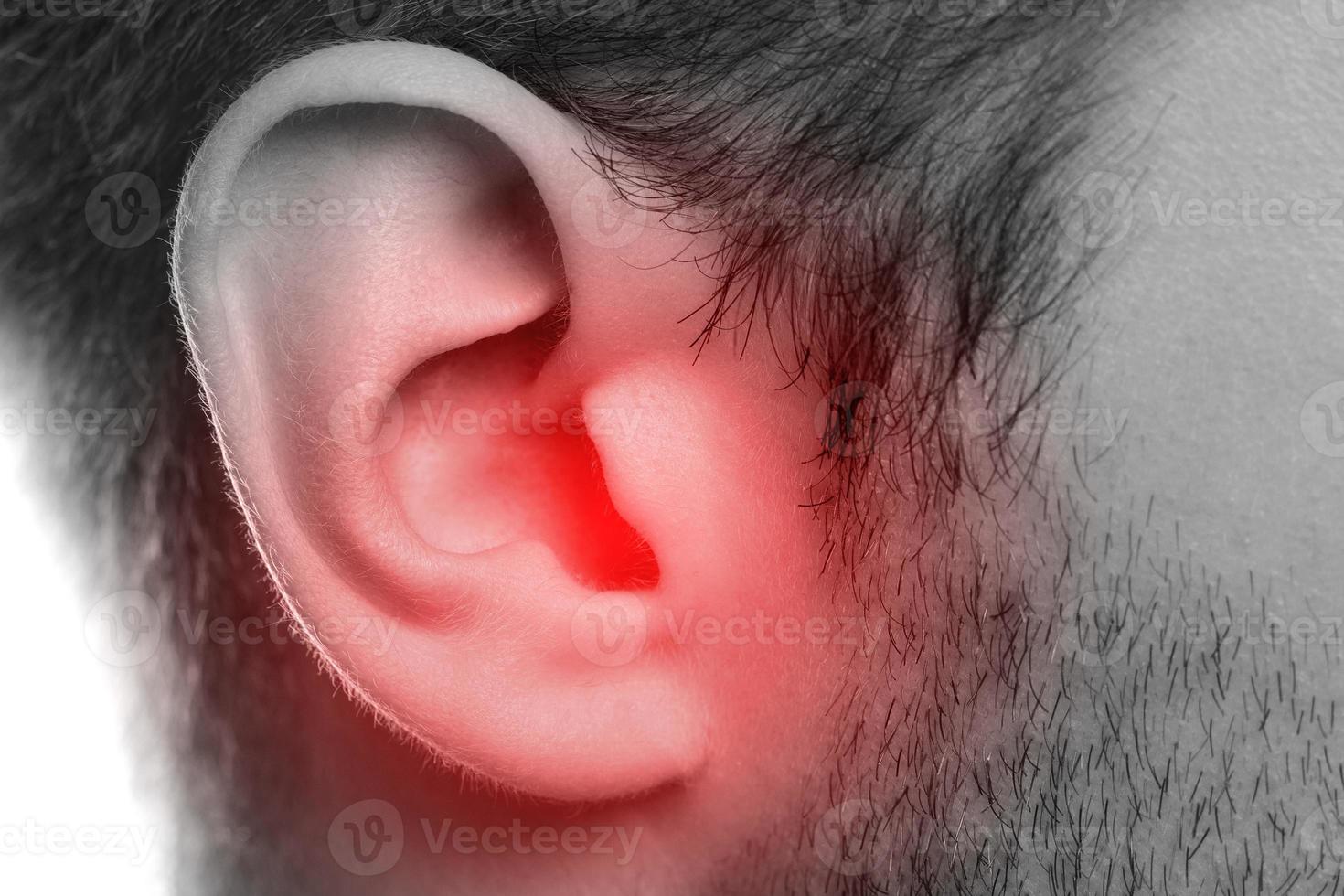 primer plano del oído masculino dolorido con fuente de dolor foto
