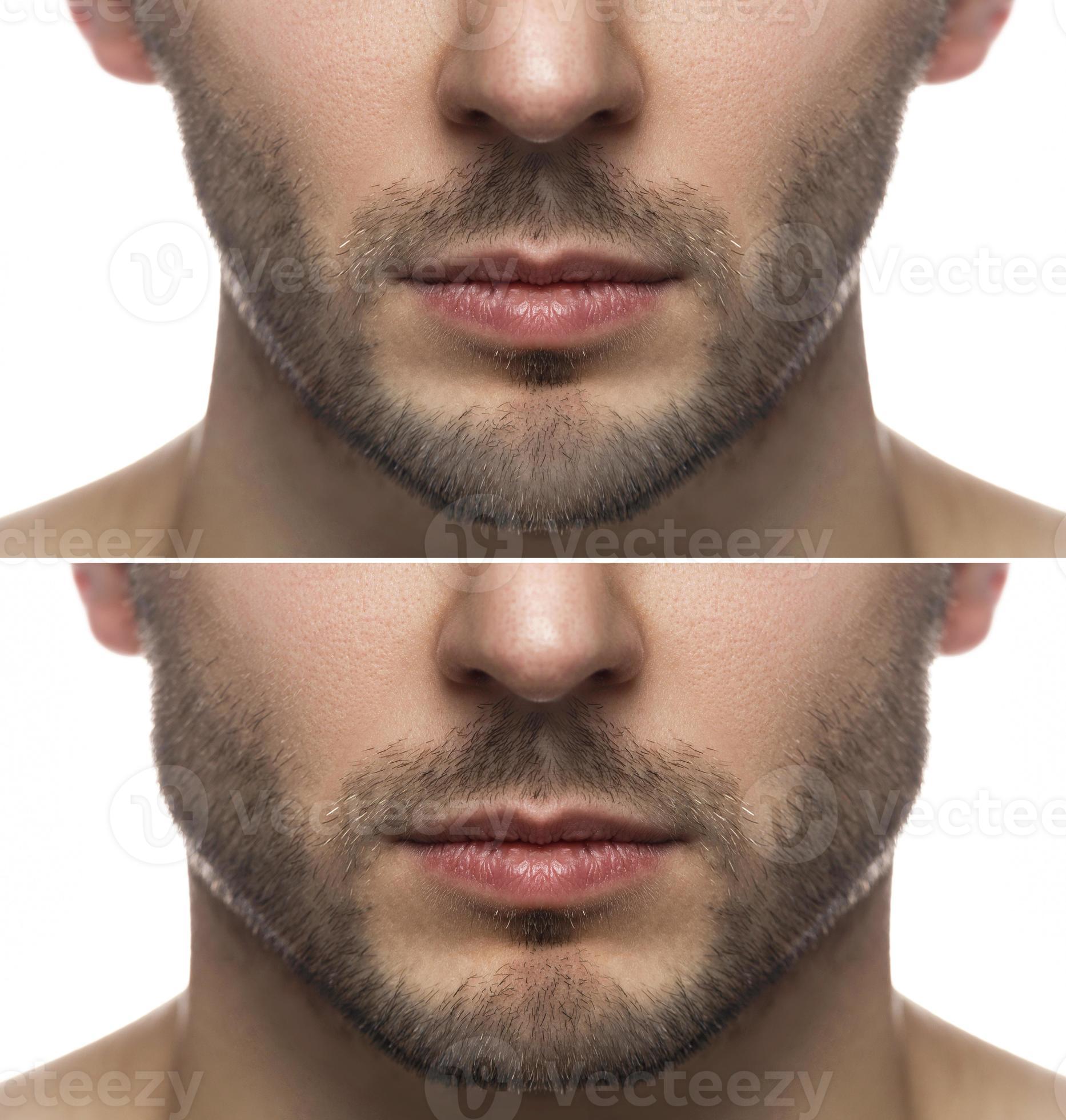 Mewing exercises. Result of a jawline reshape. 16250461 Stock Photo at  Vecteezy