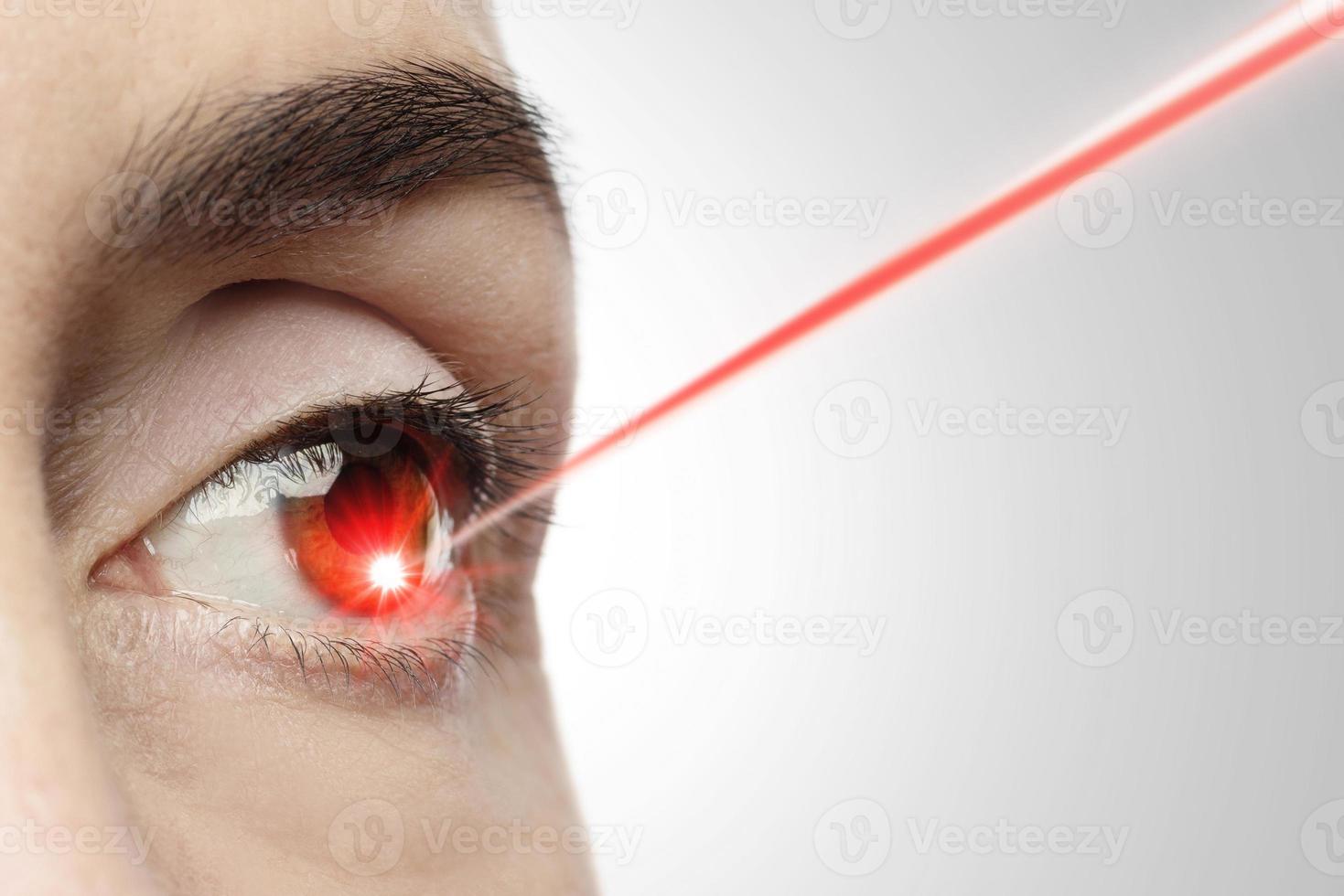 Female eye with a laser beam pointing into the iris photo