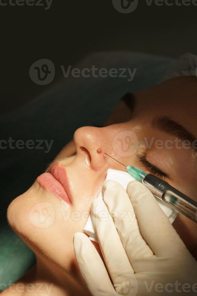 Woman getting injection of local anesthetic before mole removal