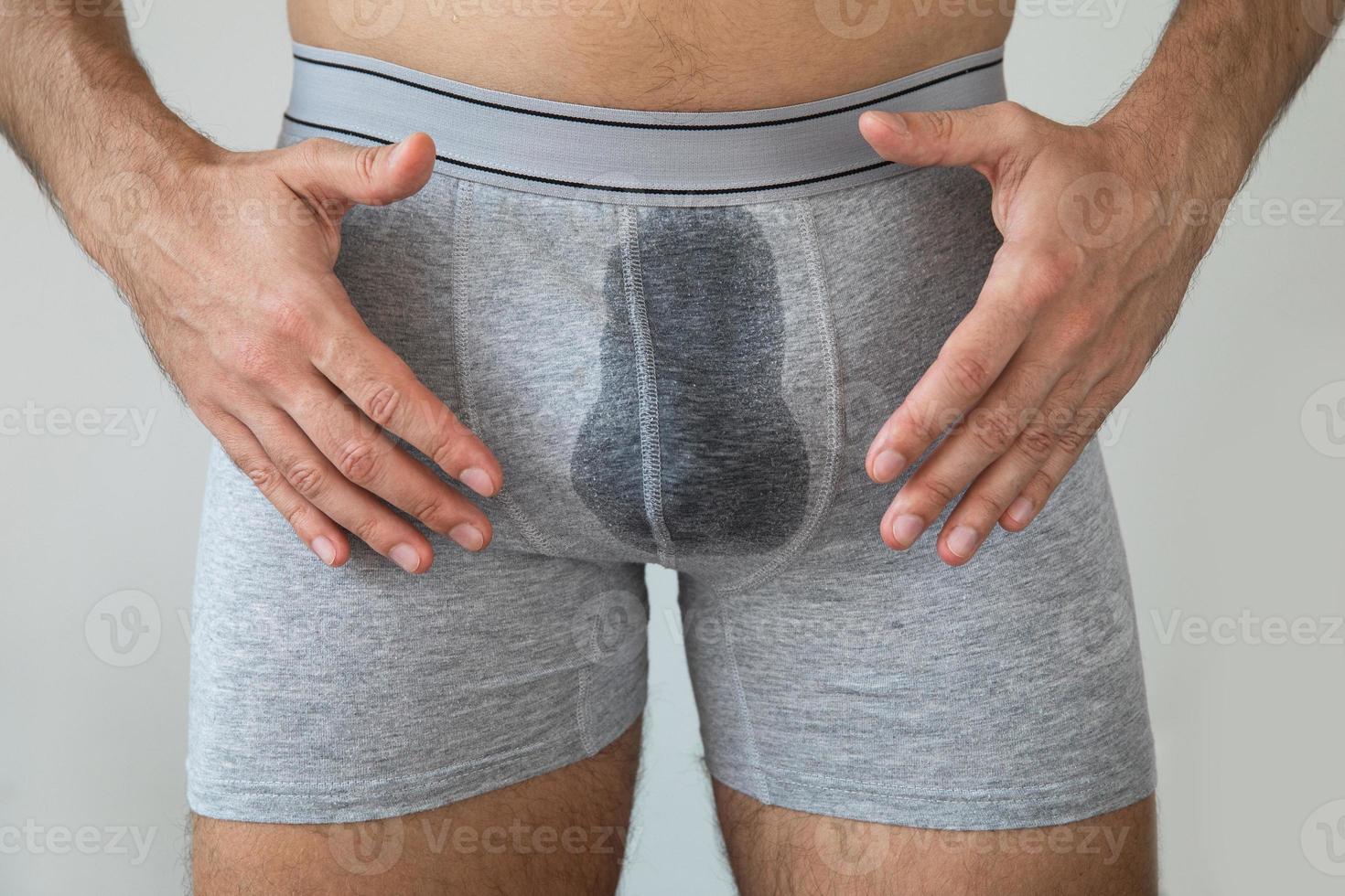 Man with wet briefs because of urinary incontinence photo