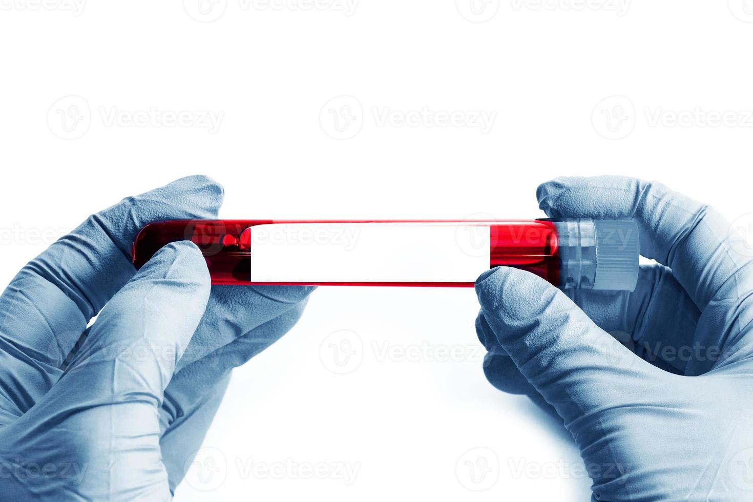 Close up of scientist hand with a blood ampoule photo