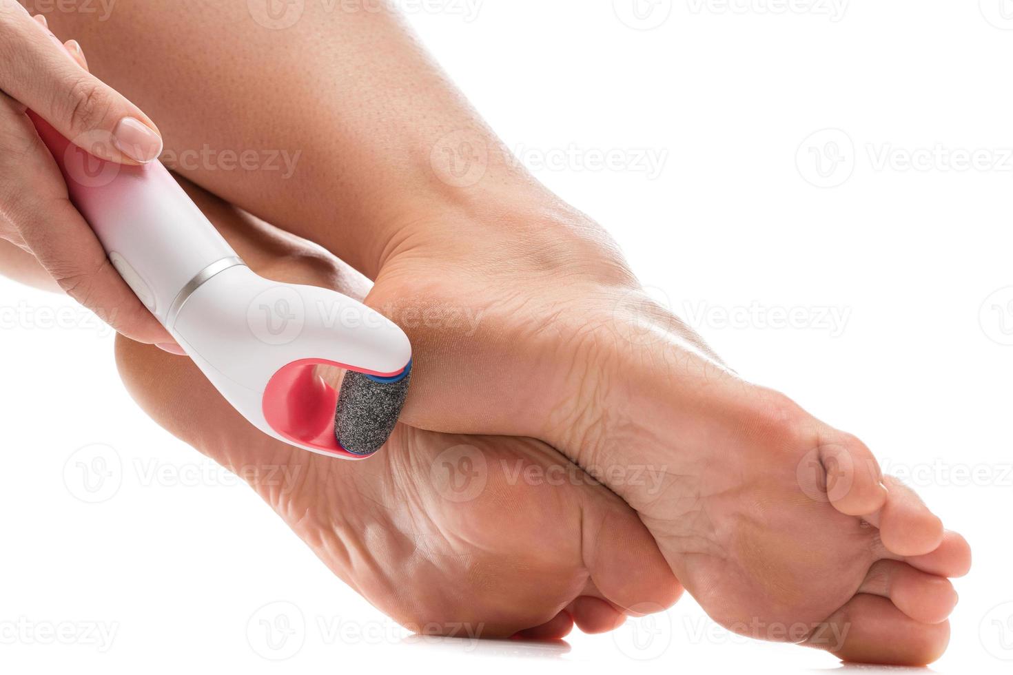 Female feet and electric foot file for callus and dead skin removal on white background photo