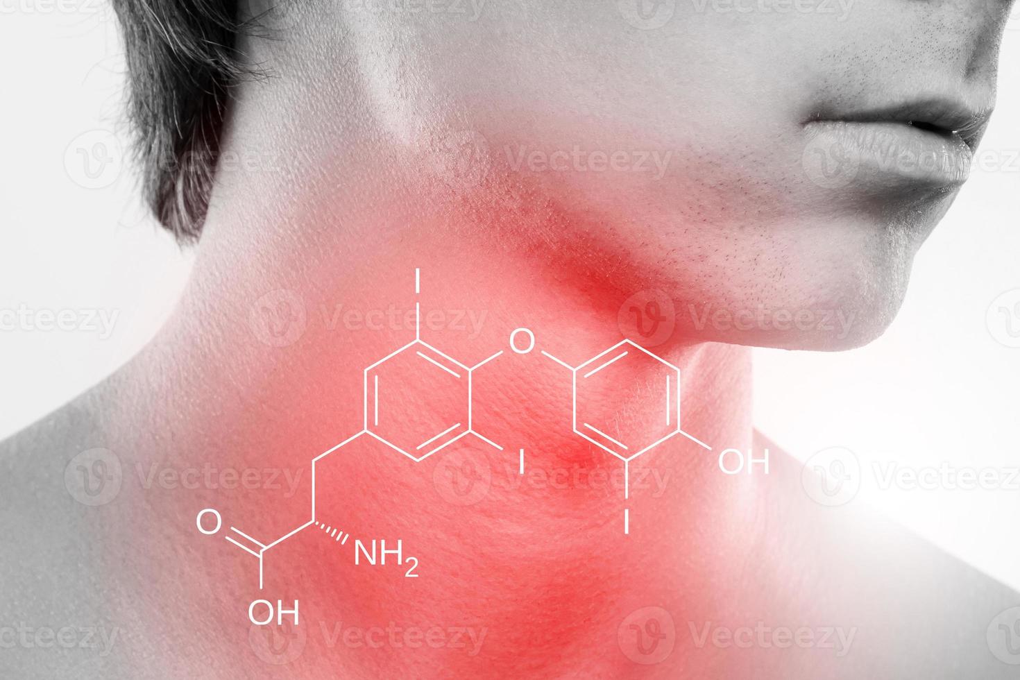 Male neck and triiodothyronine hormone formula photo