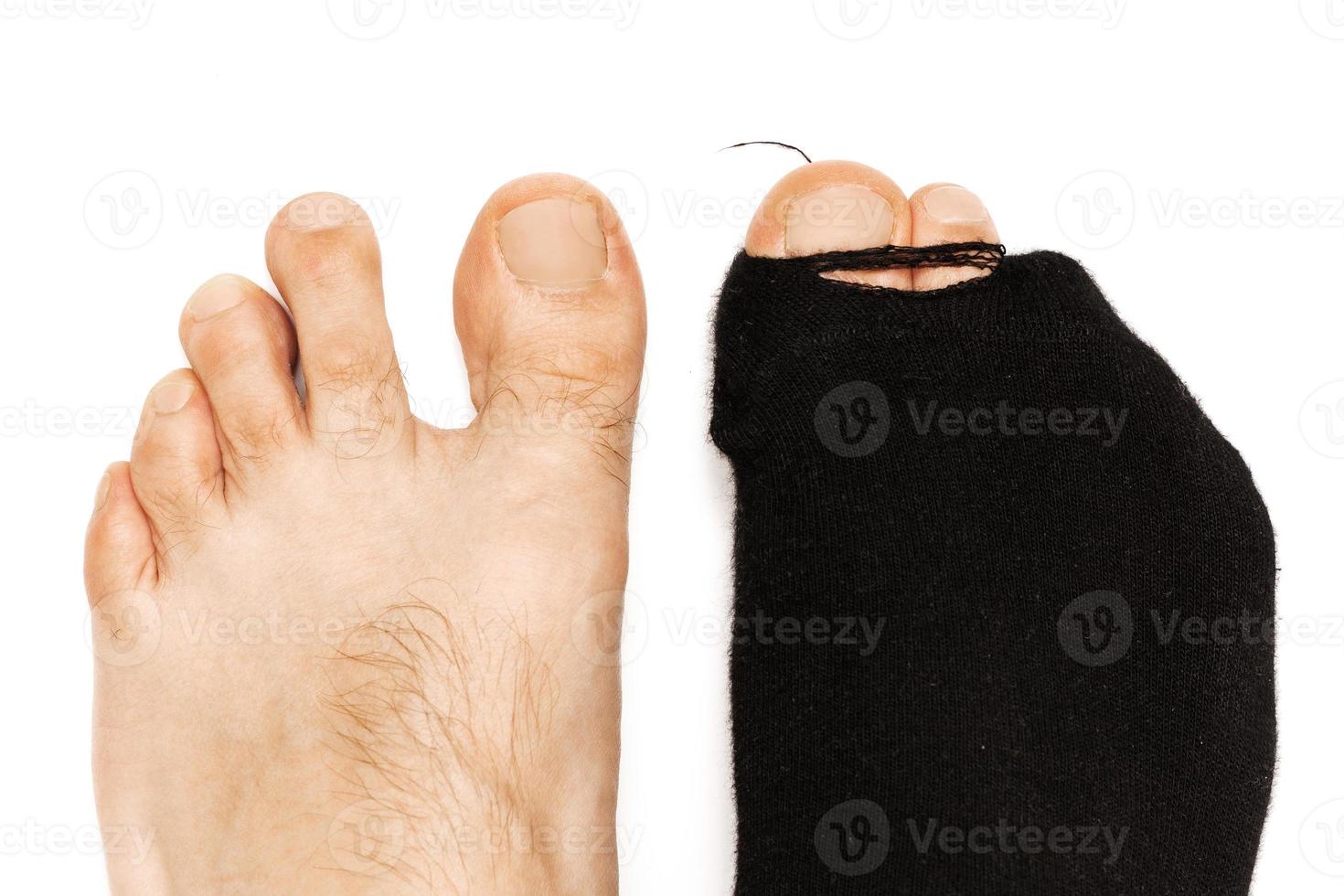 Closeup shot of male feet with a toe sticking out from hoaly sock. photo