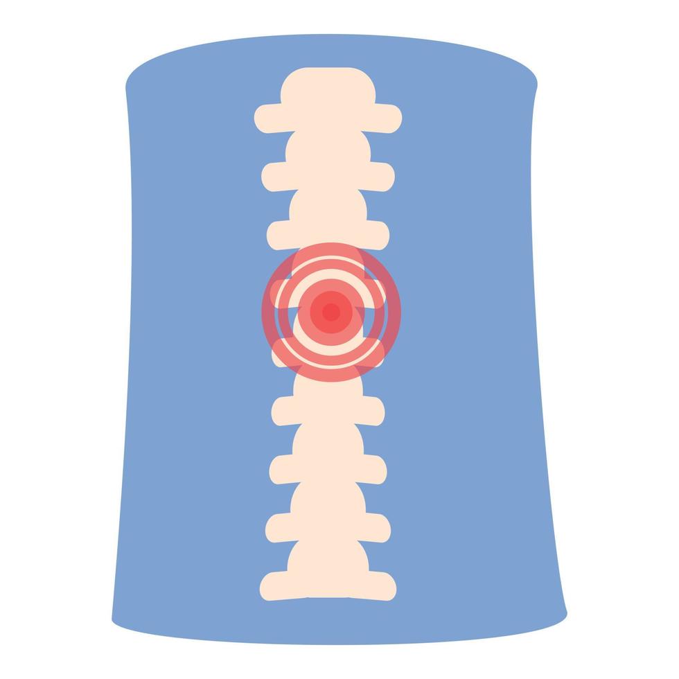 vector de dibujos animados de icono de dolor de columna. articulación de la artritis