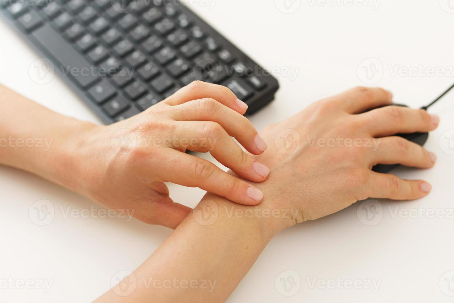 Female hands with a pain in the wrist because of carpal tunnel syndrome photo