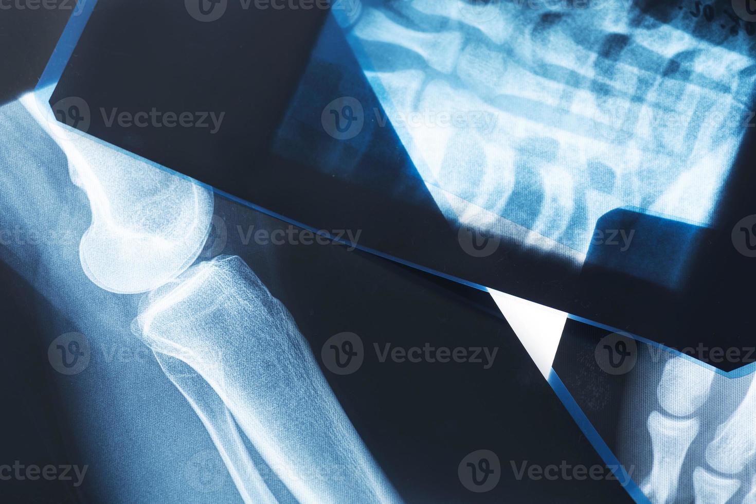 Close-up of different x-ray images photo