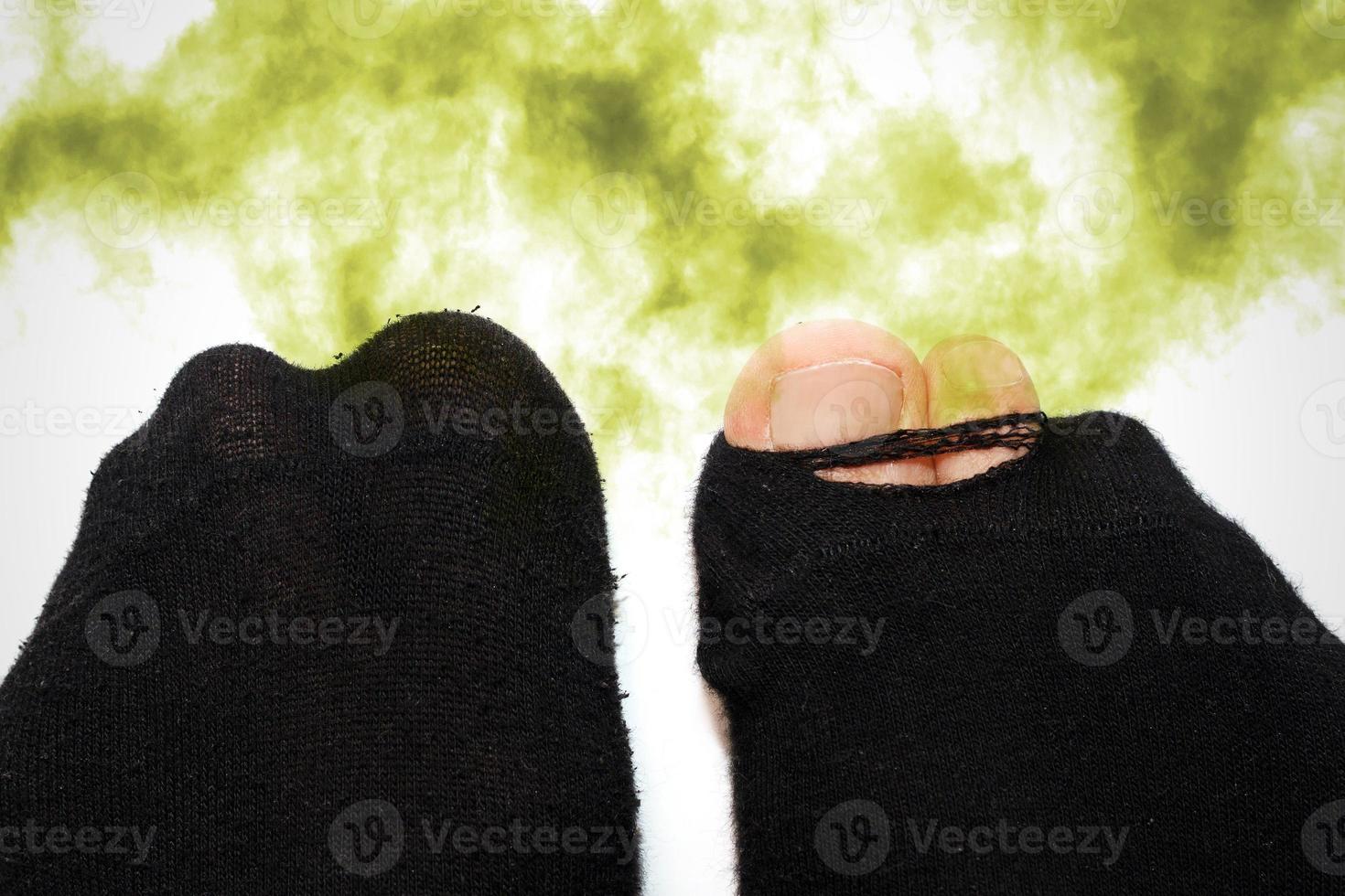 Male feet in old smelly and dirty socks photo