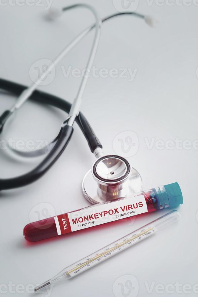 Vacutainer with monkeypox blood sample for testing photo