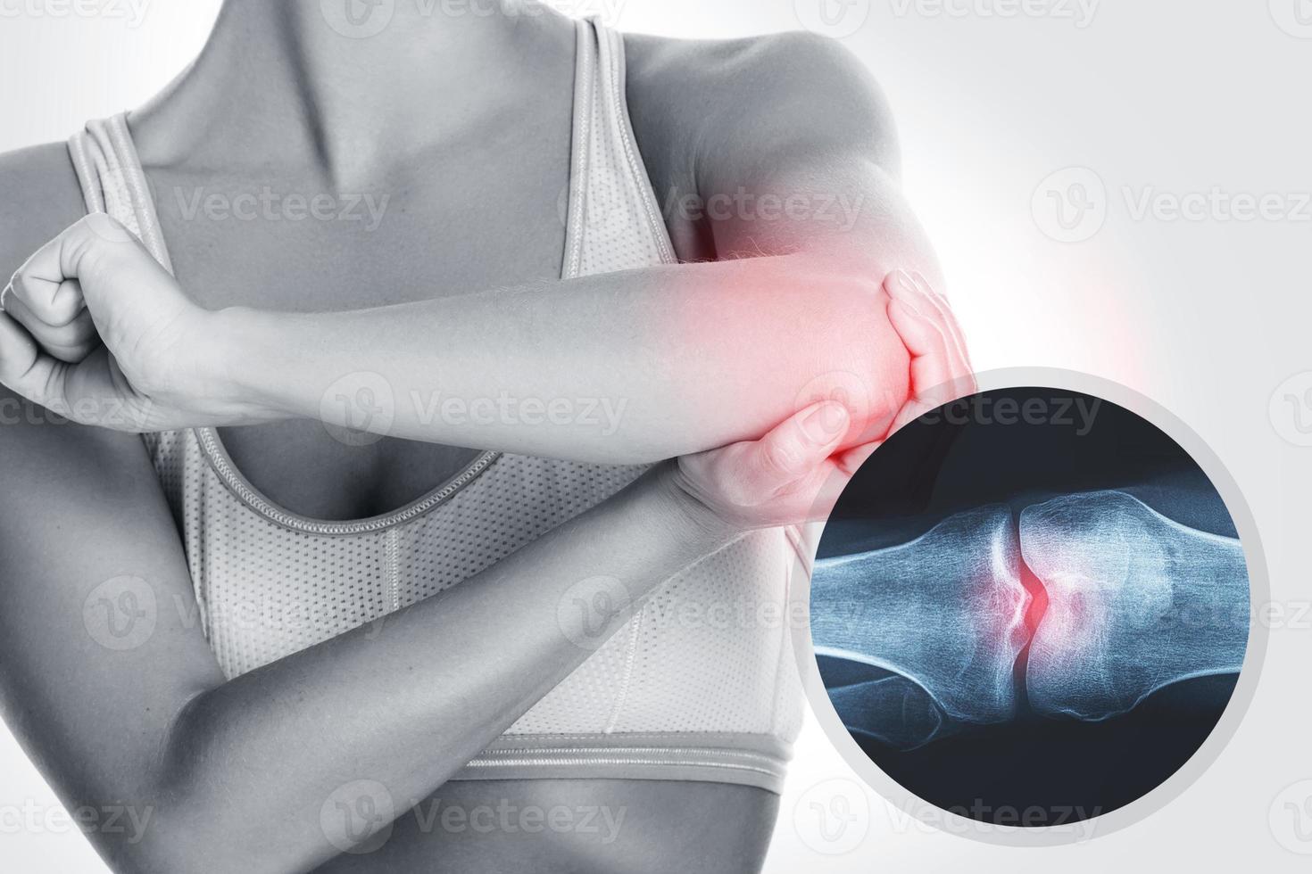 Elbow and and X-ray effect with an injured joint photo