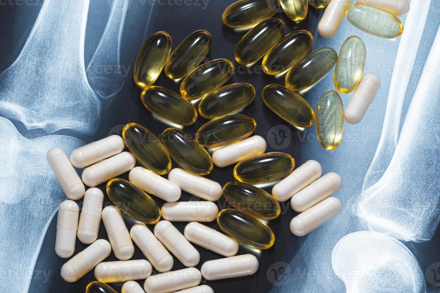 Close-up of X-ray image and different pills and capsules photo