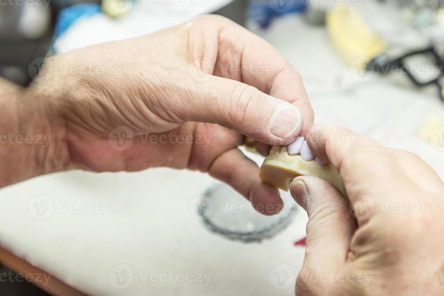 Dental Technician Working On 3D Printed Mold For Tooth Implants photo