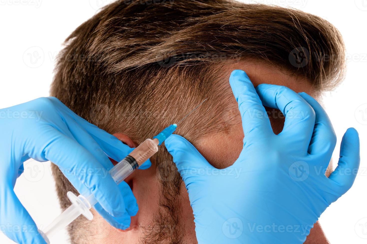 hombre que recibe una inyección en el cuero cabelludo para que crezca el cabello foto