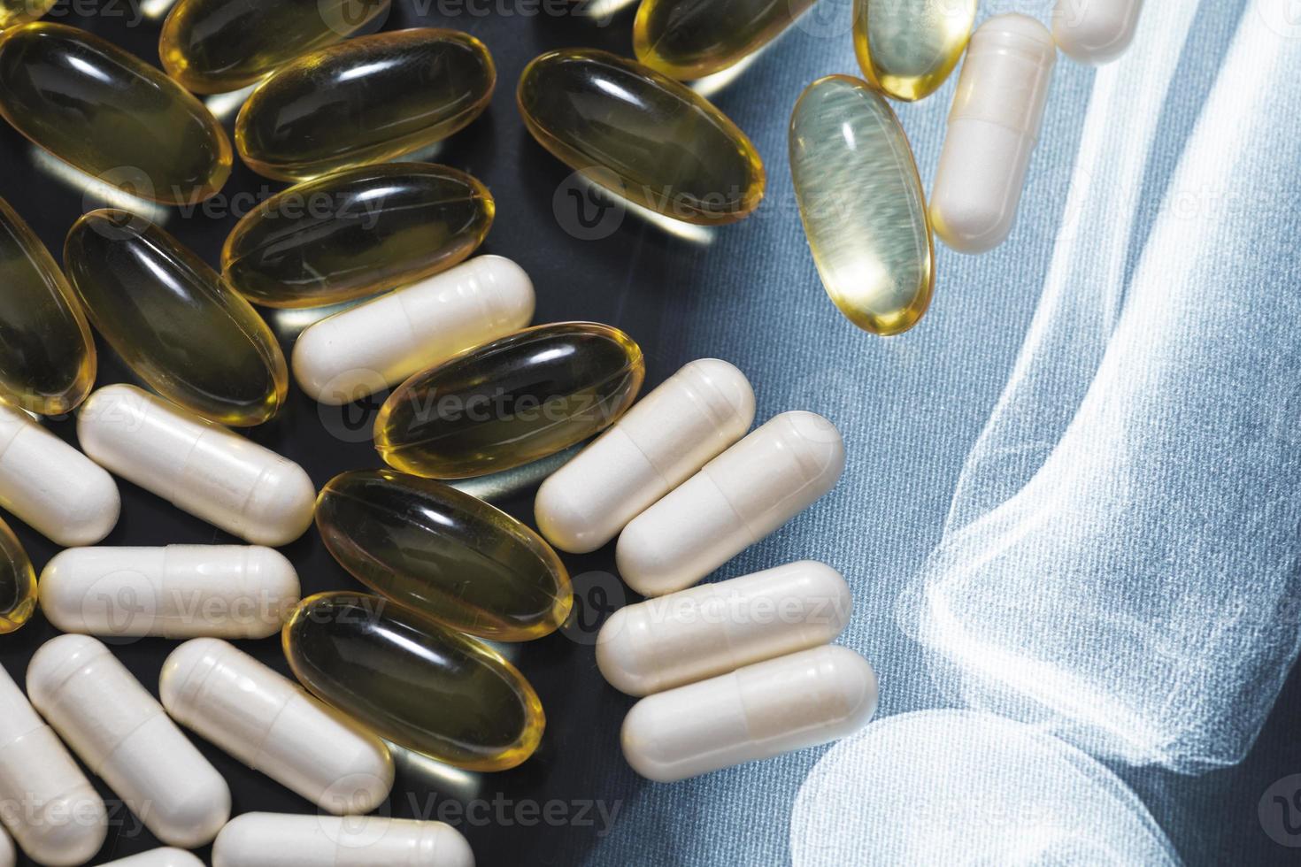 Close-up of X-ray image and different pills and capsules photo