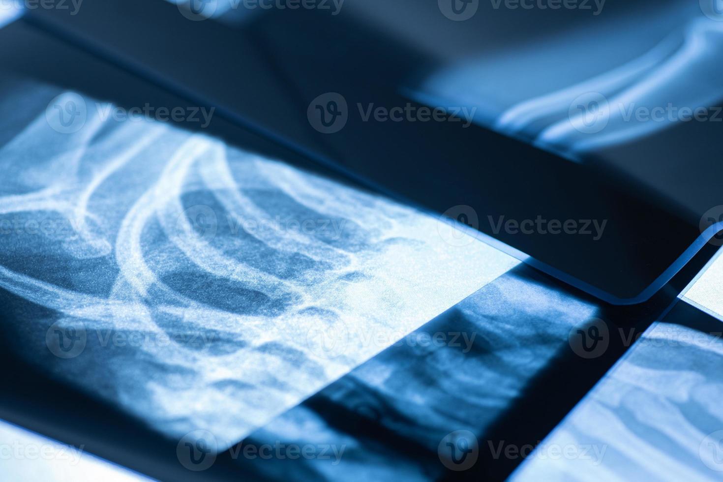 Closeup of different x-ray images on the table photo