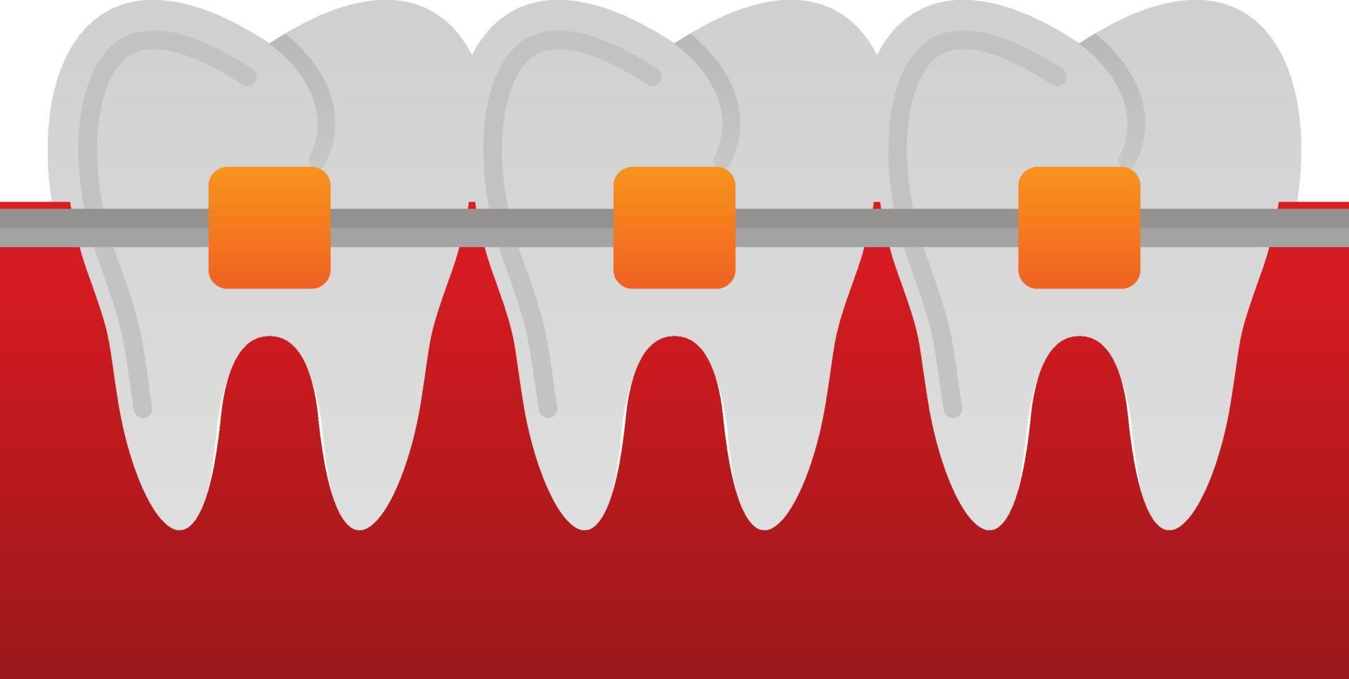 Braces Vector Icon Design