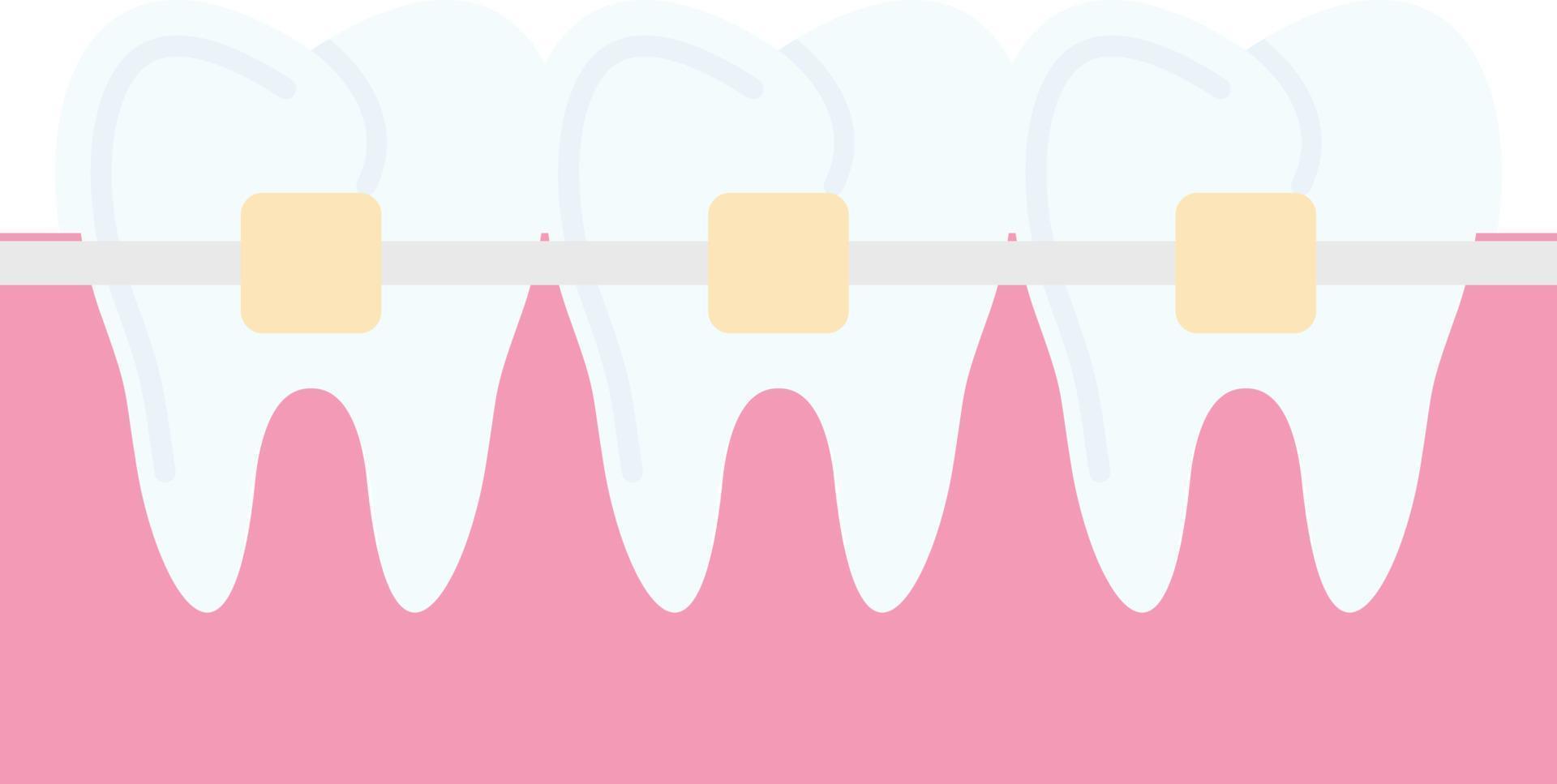 Braces Vector Icon Design