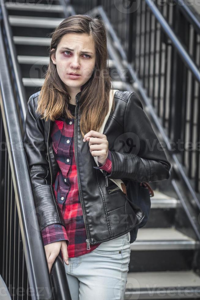 Young Bruised and Frightened Girl With Backpack on Staircase photo