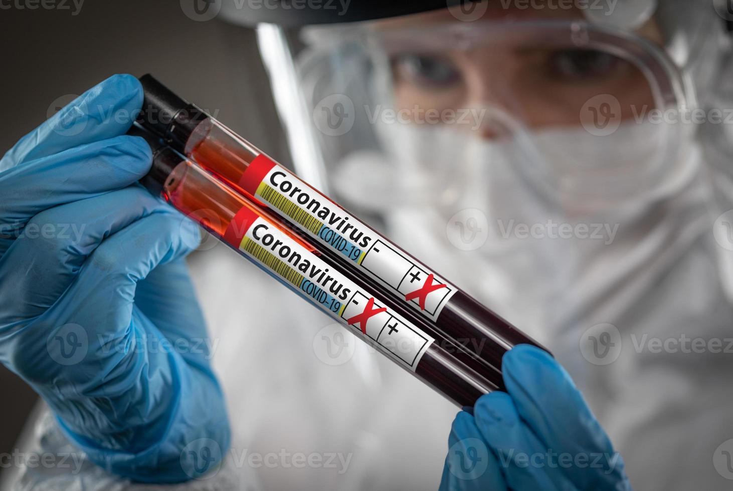 Female Lab Worker Holds Test Tubes of Blood Labeled Coronavirus COVID-19 Disease photo