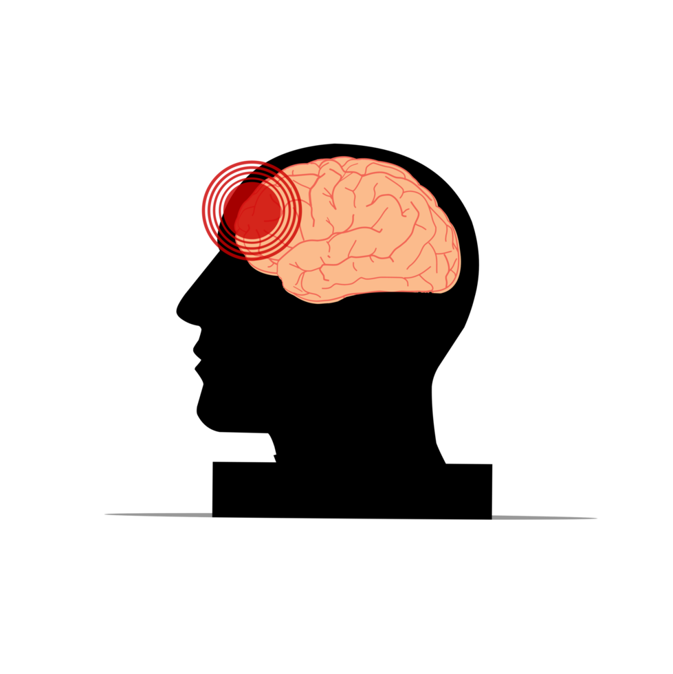 dor de cabeça e trauma cerebral png