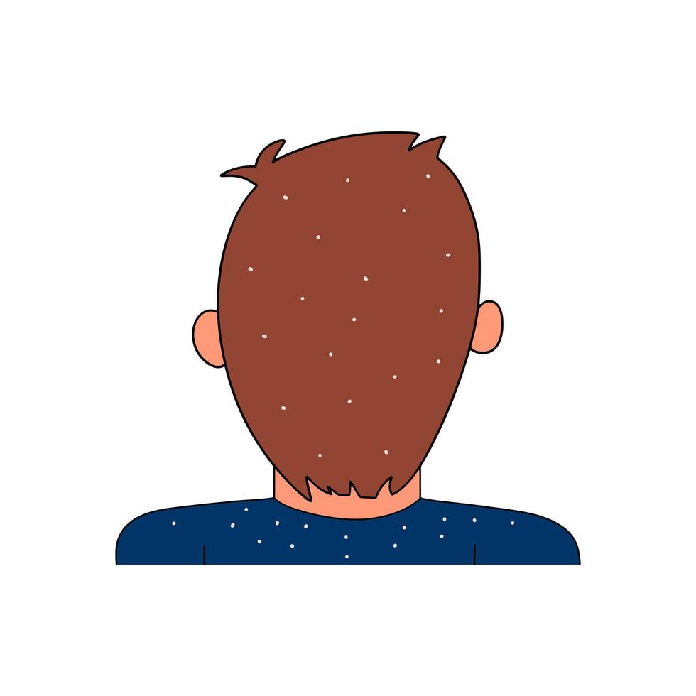 hombre con caspa en la cabeza, ilustración vectorial en estilo plano vector