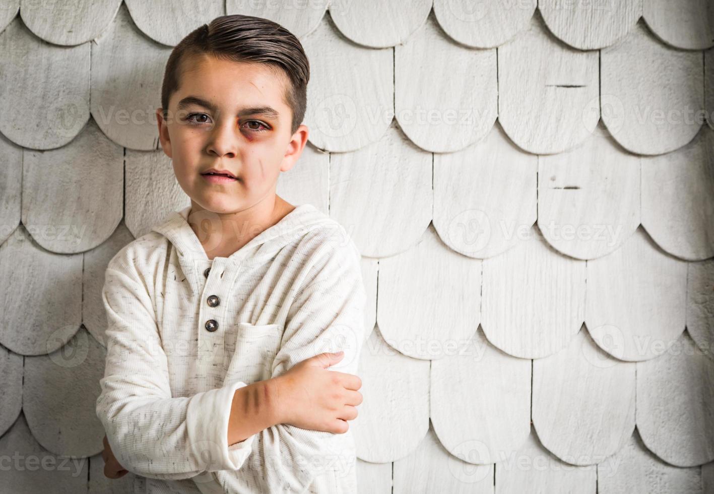 Sad and Afraid Mixed Race Boy With Bruises and Black Eye photo