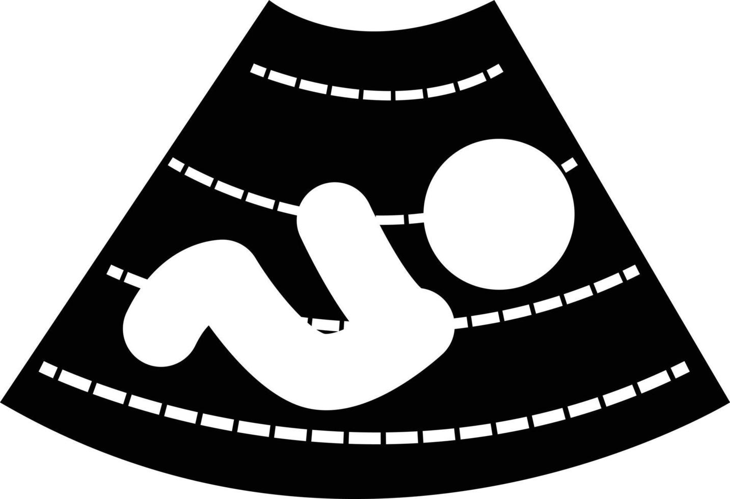 icono de bebé de ultrasonografía sobre fondo blanco. signo de ultrasonografía. estilo plano vector
