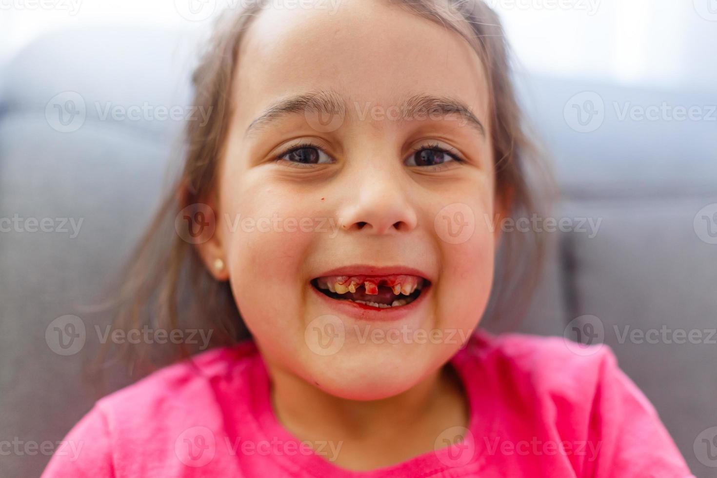 Retrato cerrado de una niña divertida y sonriente sin un diente delantero foto