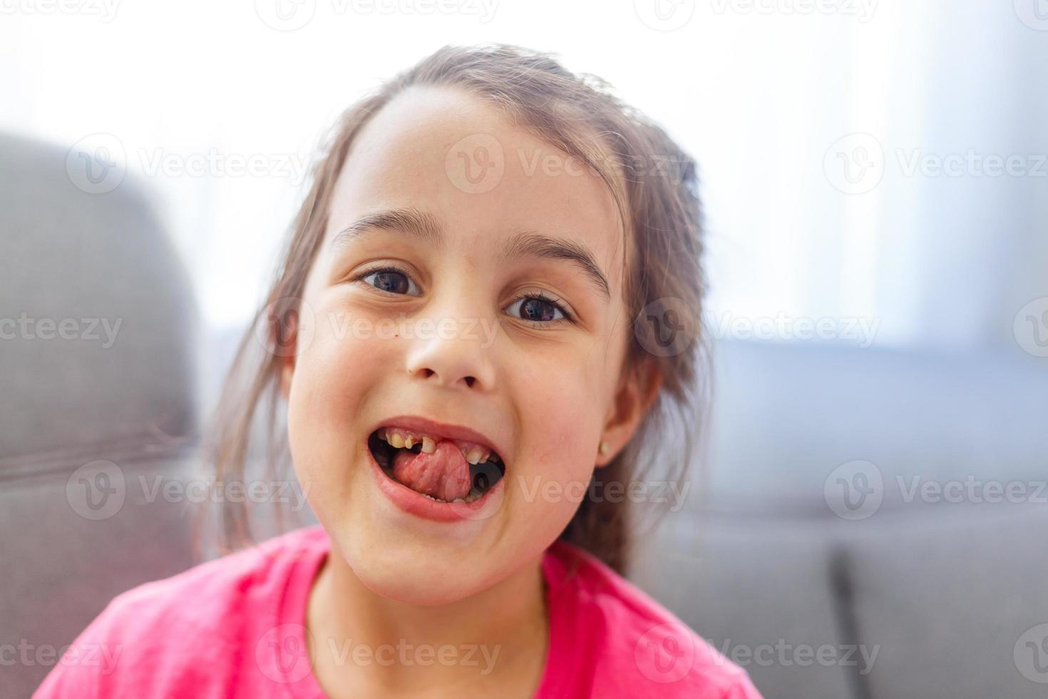 Young baby's teeth are shown close-up. A child's smile without one tooth photo