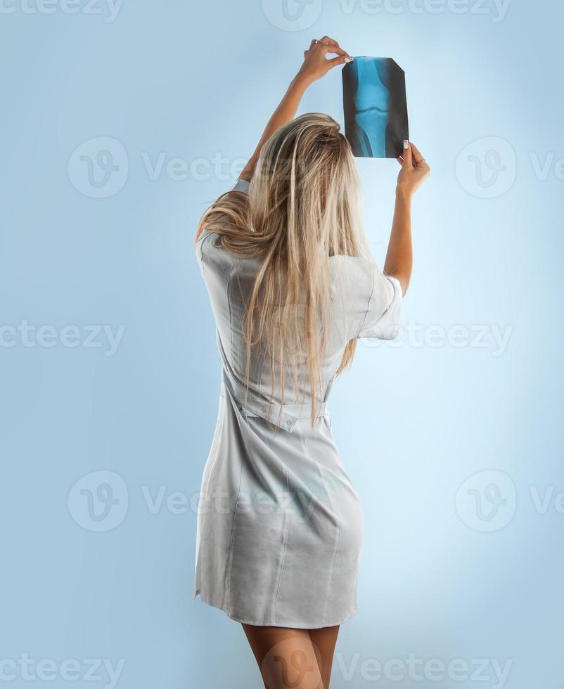 Blonde woman looking at x-ray photo from backside