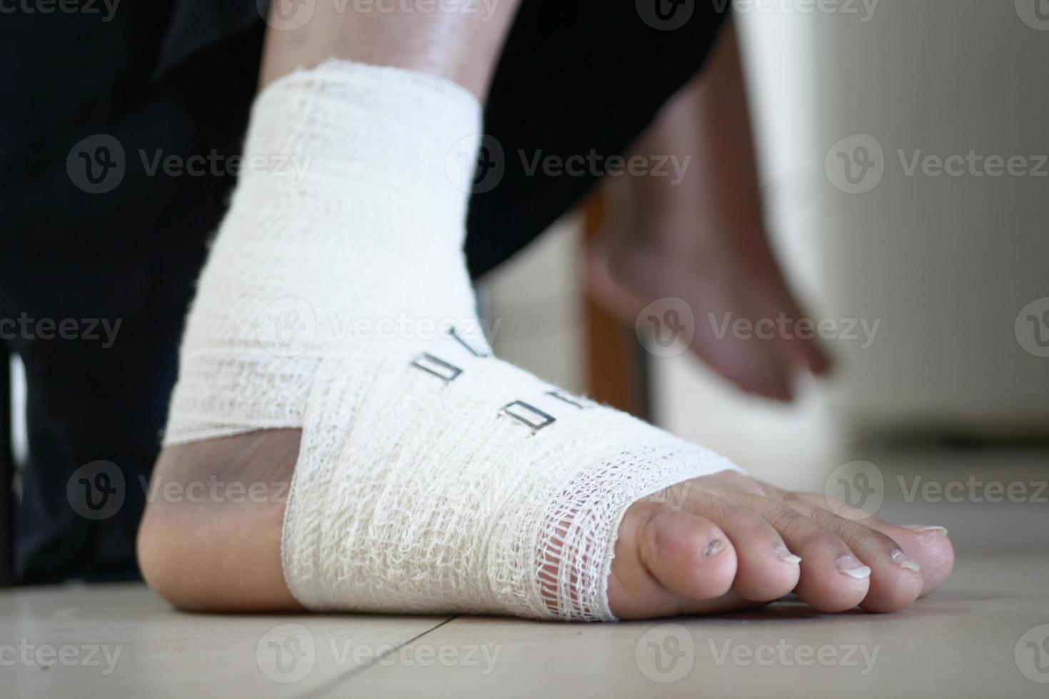 Woman with bandaged foot close up photo