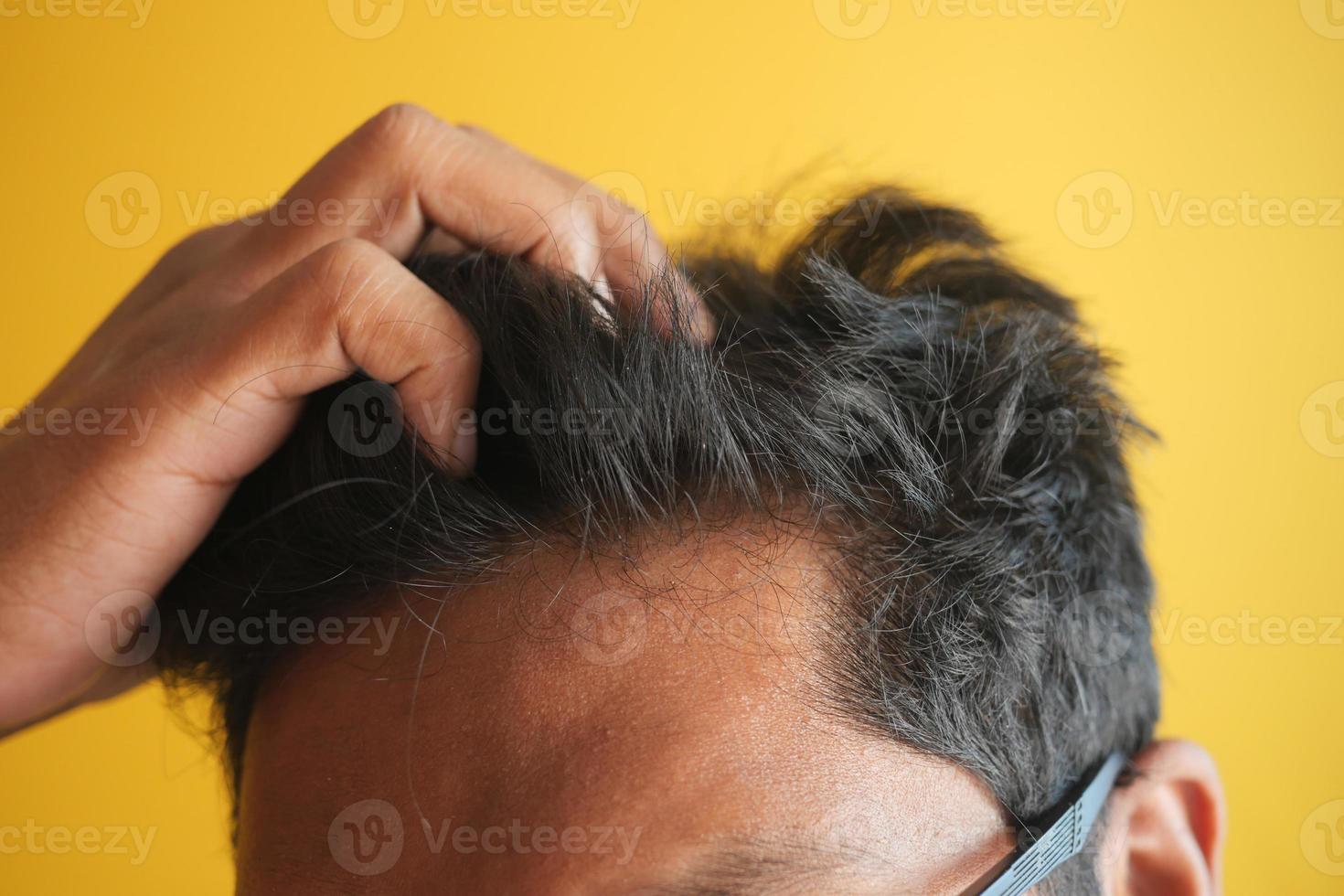 hair loss concept with man checking his hair photo