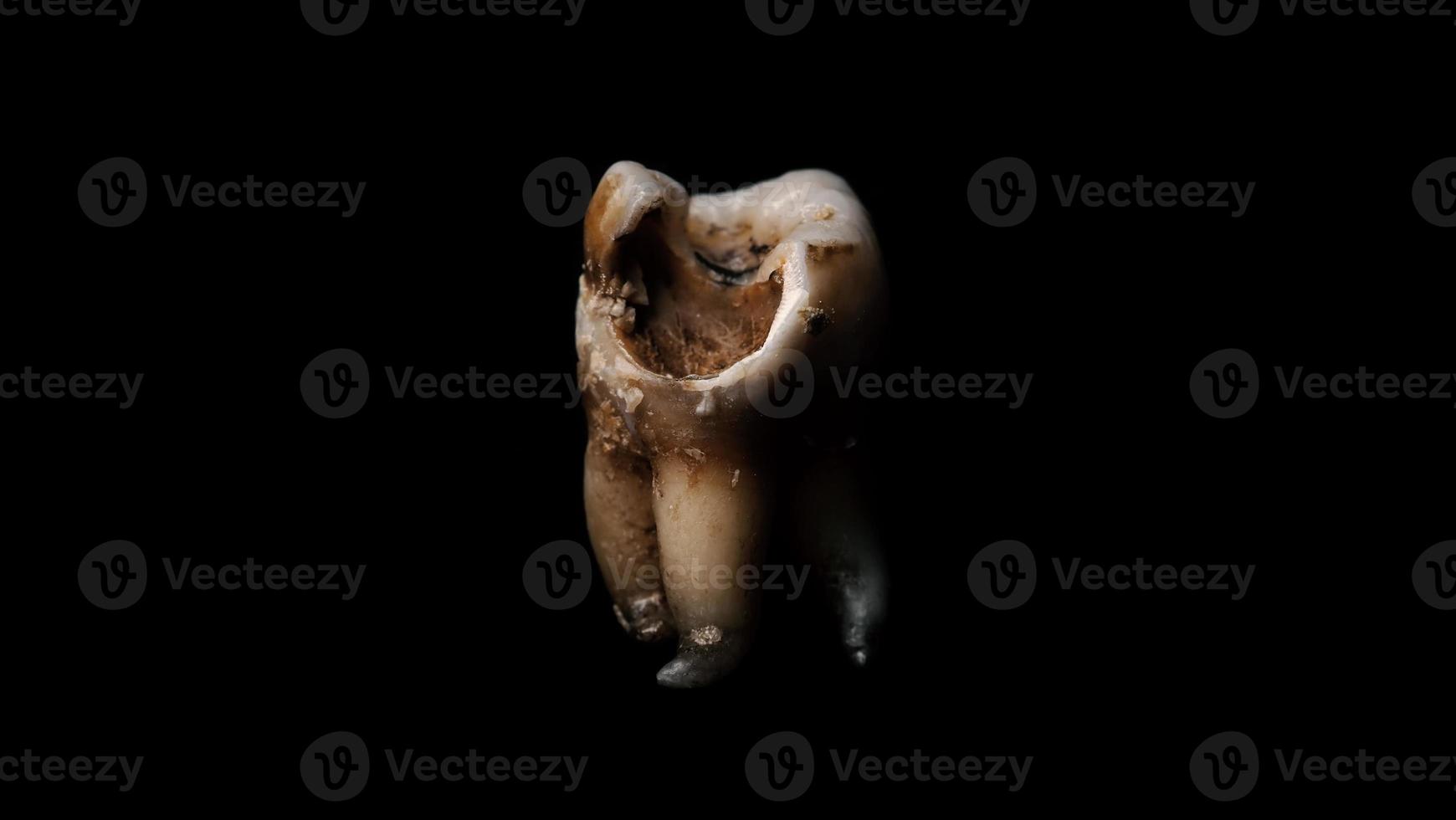 Macro shot of a decayed teeth till root after extraction of dentist. photo