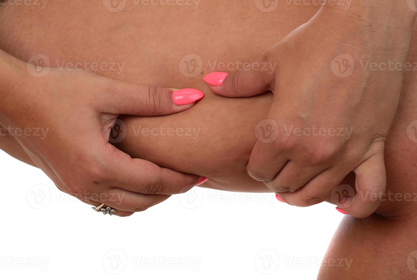 Woman pinching a fat on her legs on white background photo