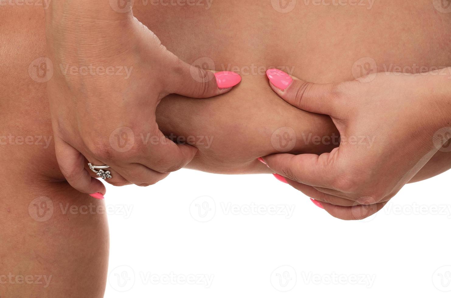 Woman pinching a fat on her legs on white background photo