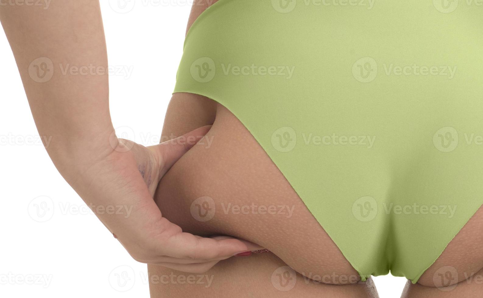 young woman checking her cellulite on her buttocks photo