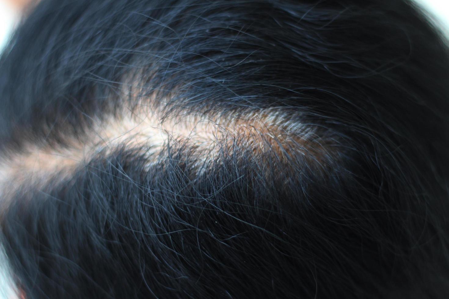 Close up gray hair roots woman photo