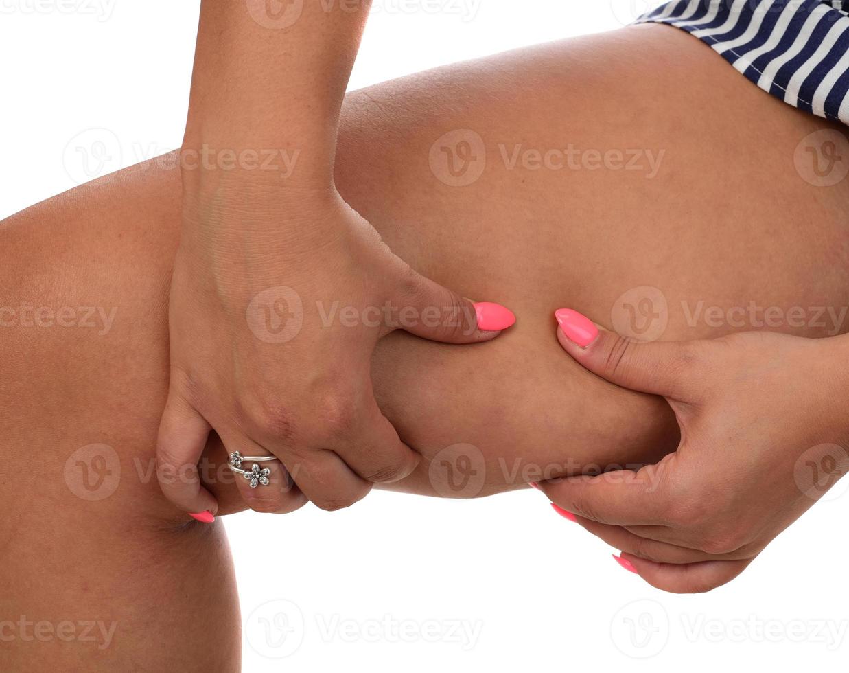 Woman pinching a fat on her legs on white background photo