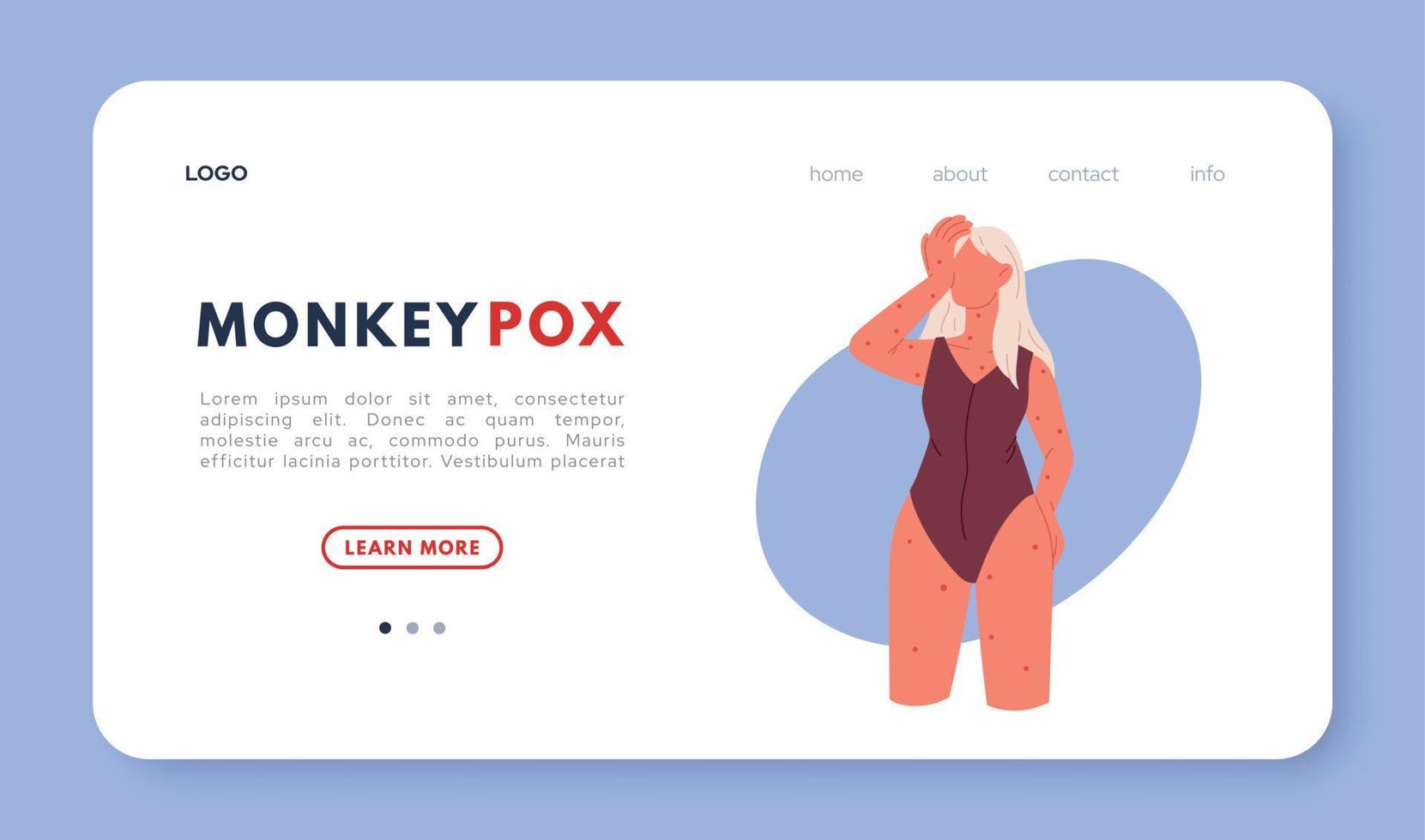 Monkeypox virus symptoms landing page. Website template of Monkeypox virus. Symptoms of Monkeypox. Woman suffering from the monkeypox virus vector